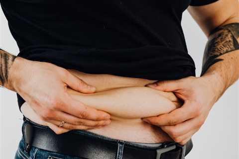 Adolescent obesity linked to increased risk of stroke as an adult – AHA Study