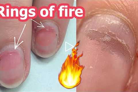 Damaged Nails transformation with Gel and Polygel | Pearl Cat Eye Design