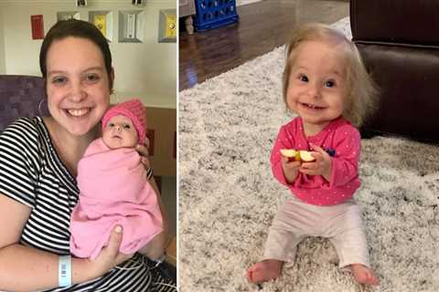 Two-year-old girl with rare form of dwarfism wears newborn sized clothes