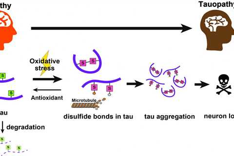 Protein Toxicity involved in Alzheimer’s triggered by a chemical ‘switch’