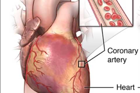 Passed All My Cardiology Tests