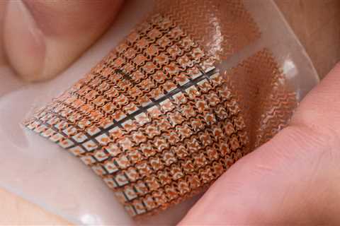 Soft Skin Patch Could Provide Early Warning for Strokes, Heart Attacks – UC San Diego