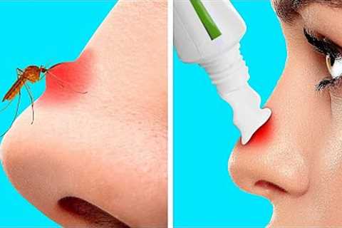 FIRST AID HACKS FOR SUMMER! Emergency Tips You Should Know