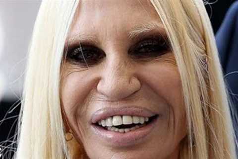 Donatella Versace's Career with Plastic Surgery: How She Ruined It