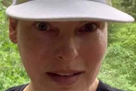 Linda Evangelista, a 'disfigured' woman sues over a cosmetic surgery mishap