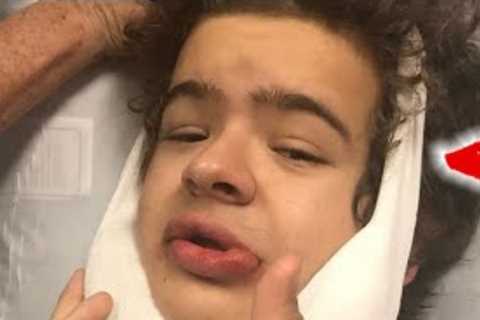 Celebrities with rare medical conditions: Top Ten