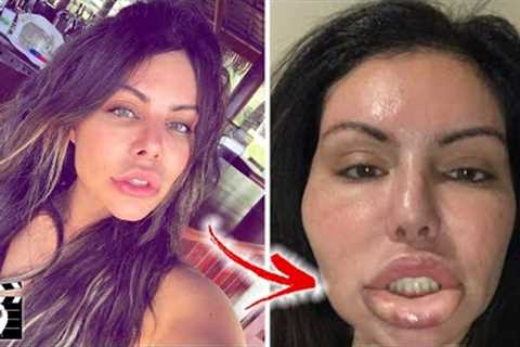 Celebrity Plastic Surgery Horror Stories: Top Ten