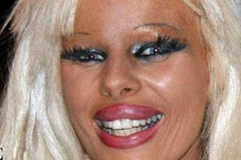 Celebrities in Hollywood Who are Unrecognizable after Plastic Surgery