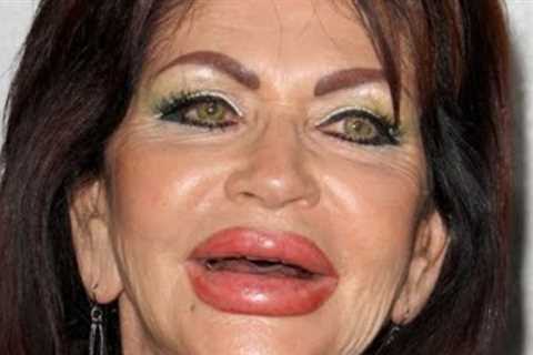 The Top 10 Hollywood Celebrities That Are Not Recognizable After Plastic Surgery Part 4