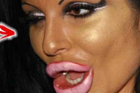 The Top 10 Actors who lost their careers in plastic surgery - Part 4.