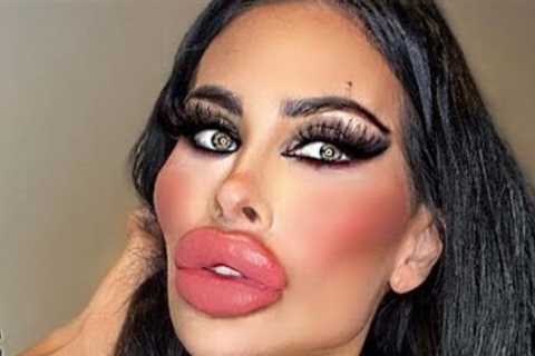 Celebrities in Hollywood Who are Unrecognizable after Plastic Surgery Part 5.