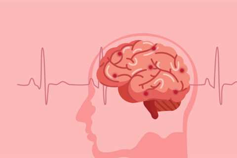 This is the critical warning sign that 75% of Stroke Victims did not notice