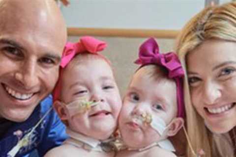Philadelphia Surgeons Successfully Separate Twin Conjoined Girls from The Chest