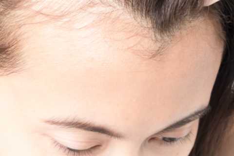The 3-Step Method to Fight Thinning Hair is a Favorite of Reviewers