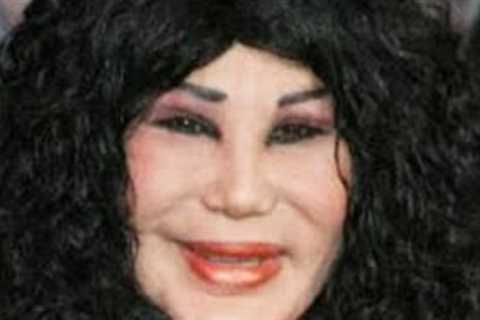 The Top 10 Hollywood Celebrities That Are Not Recognizable After Plastic Surgery Part 3