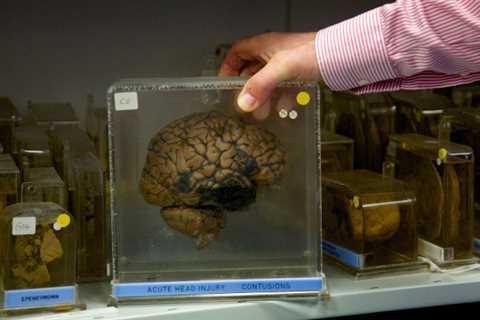Plagiarism Scandal Places Renowned Concussions Doctor under Scrutiny
