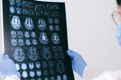 HBP - The dawn of a new paradigm in understanding the brain