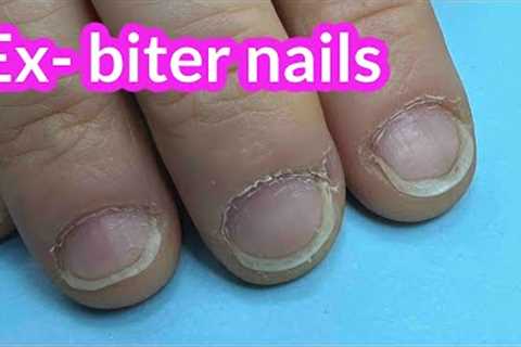 Nail Transformation of Ex- Biter With Hard Gel on Forms