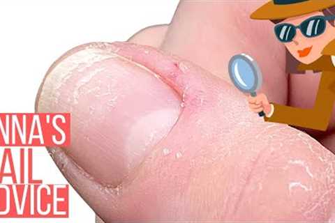 HORRIBLE CUTICLES? THINK AGAIN! This info will change everything! ?