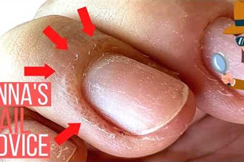 THINKING ABOUT GEL POLISH? YOU NEED TO KNOW WHY THIS HAPPENS [ALLERGIC REACTIONS &amp; OVEREXPOSURE]