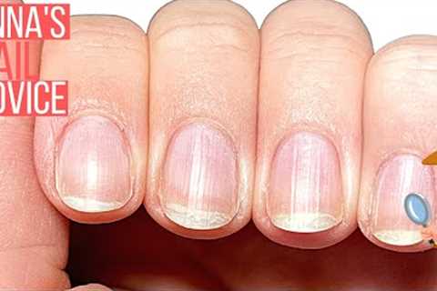 PEELING, BENDY NAILS? WHAT DO I DO?! ANNA, HELP!! [ANNA'S NAIL ADVICE]