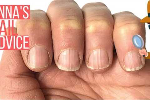 RIDGY NAILS? THE ONLY SOLUTION. [ANNA'S NAIL ADVICE]