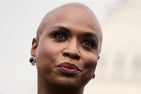 Why is a woman bald?
