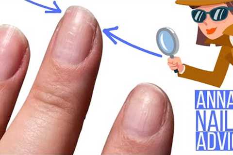 Torn Nails Problem [Anna's Nail Advice]