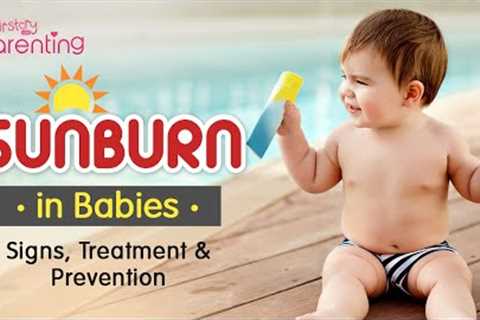 Easy Tips &amp; Precautions for Baby Sunburn