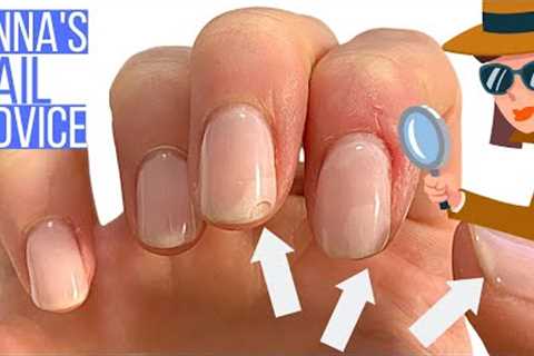 10 Reasons Why Shellac Chips &amp; Peels. [ANNA'S NAIL ADVICE]