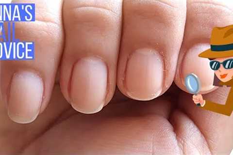 Soft &amp; Peeling Nails, WHY?! [ANNA'S NAIL ADVICE]