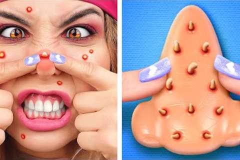Don’t touch the PIMPLES *Amazing TOYS and GADGETS from Tik Tok*