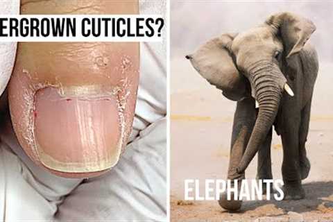 What Do Elephants &amp; 'Overgrown Cuticles' Have In Common?