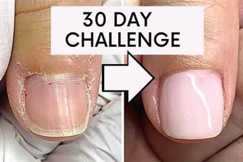 CONTEST TIME!!! WIN PRIZES Overgrown Skin Around The Nails, NOT CUTICLE! challenge  💵  💅