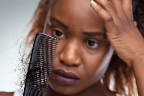 Your Diet May Be Contributing To Your Hair Loss 