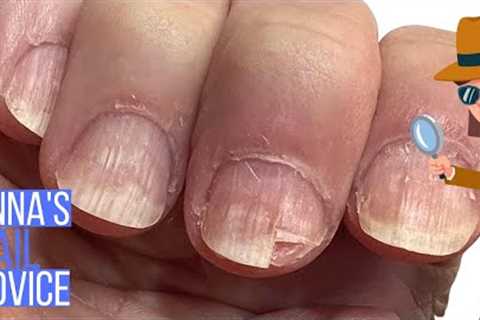 Strange Nail Damage After Builder Gel?  [ANNA'S NAIL ADVICE]