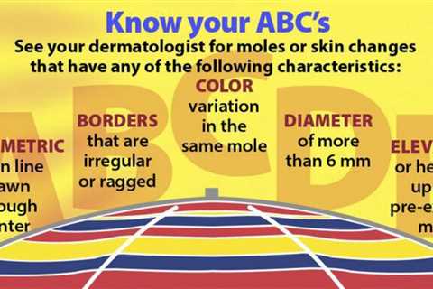 Get smarter about skin cancer