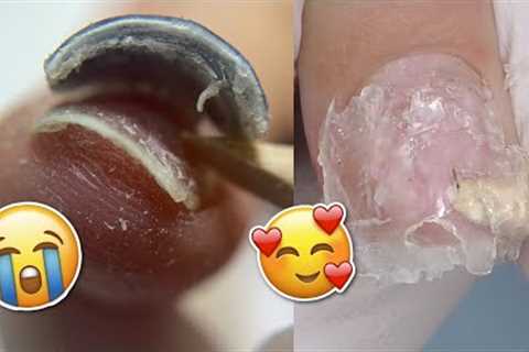 Damage FREE Soft Gel Nail Extensions Removal