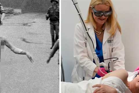 Kim Phuc, Vietnam War 'Napalm Girl,' Gets Final Burn Treatment 50 Years Later