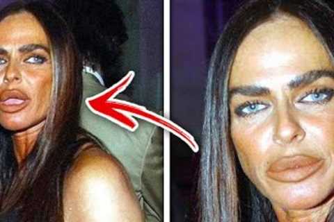 Top 10 Celebrities Who Got Botched From BAD Plastic Surgery