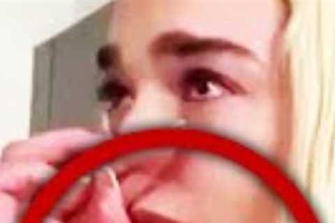 Top 10 Celebrities Who Went WAY Too Far With Plastic Surgery