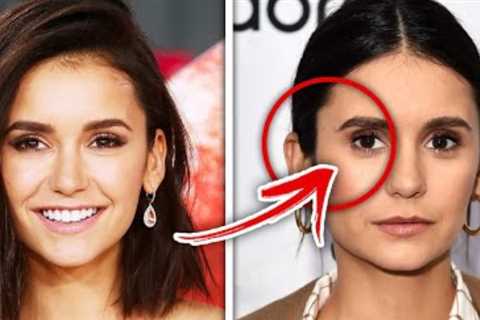 Top 10 Celebrities Who Look WORSE After Plastic Surgery