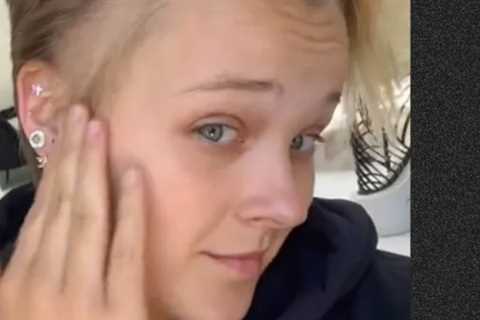 JoJo Siwa Reveals Bald Spot in TikTok Video Due to 'Stress Rash' From Her Time on Dance Moms