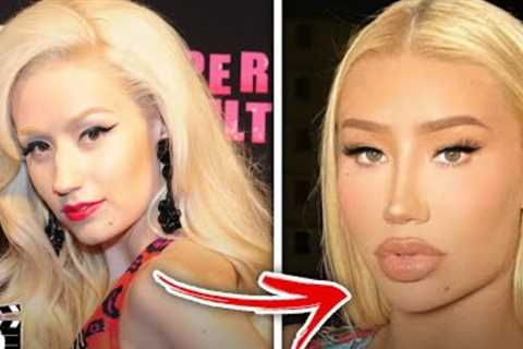 Top 10 Celebrities Who INSTANTLY Regretted Their Plastic Surgery