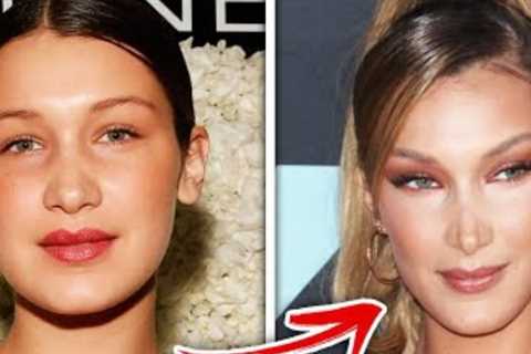 Top 10 Celebrities Accused Of Lying About Plastic Surgery