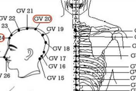 Migraine Headaches: 8 Pressure Points For Migraine Relief