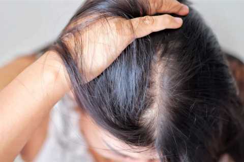 Female Pattern Hair Loss Is Real: A Powerful Solution To This Common Problem In Women