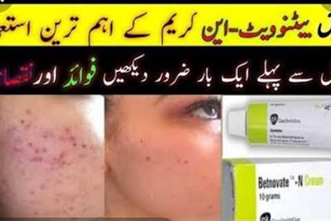 Best Cream For PimleslBestl cream For acne| Best Cream for pimples in pakistan