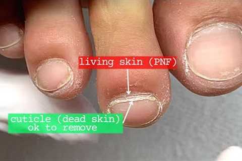 Don't Push Back the Cuticle.