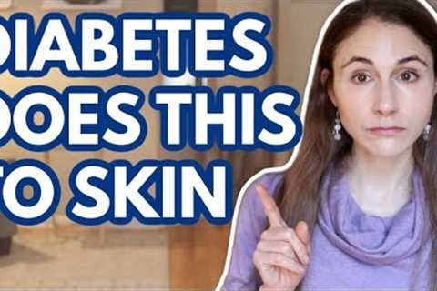 WHAT DIABETES DOES TO YOUR SKIN // DERMATOLOGIST @Dr Dray